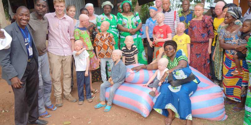 Gemeinschaft Menschen mit Albinismus Atakpam&eacute;